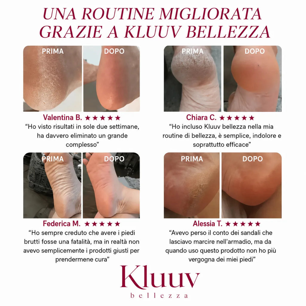 Kluuv™ - Kit Bellezza Piedi ✨