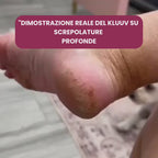 Kluuv™ - Kit Bellezza Piedi ✨